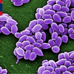 警戒！カンボジアと国境を接するラオスの州で炭疽菌感染52人を確認　